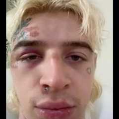 Most Delusional Influencer Ever