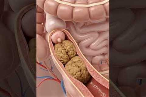 Illustration of Constipation Moving | Gut Health | Anatomy Art USA