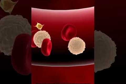 Prevent nerve pain due to Diabetes 5 | Diabetic Neuropathy