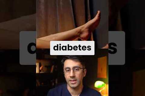 Diabetes WARNING Signs in Feet / Legs  #type2diabetes  #diabetessigns #prediabetes