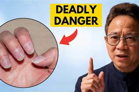 13 Hidden Signs Your Body Lacks Nutrients