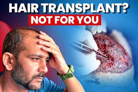Stop! Don’t Get a Hair Transplant Until You See This