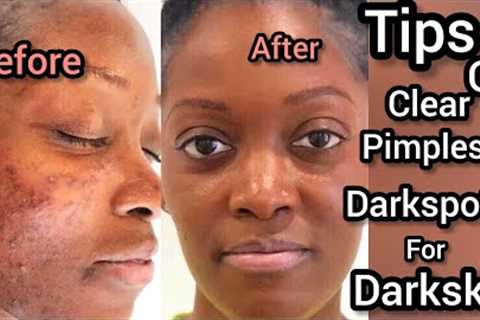 Clear pimples and darkspots With My morning and night simple skincare routine !