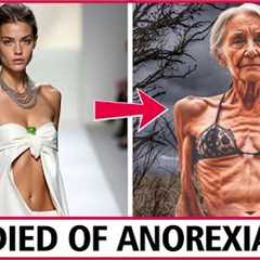 25 Celebrities You Won't Believe DlED OF ANOREXlA | Try Not to Gasp at Them Today!
