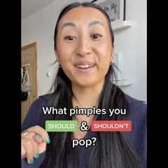 What pimples you SHOULD and SHOULDN’T pop?