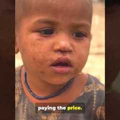 Gaza Famine: UN’s Shocking Warning | Gaza Turns Into a Famine Zone | Global Crisis Explained