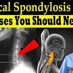 Cervical Spondylosis (DJD) Exercises You Should Never Do (Correct Exercises) - Dr. Alan Mandell, DC