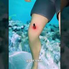 How Stingrays Actually Sting You 😳