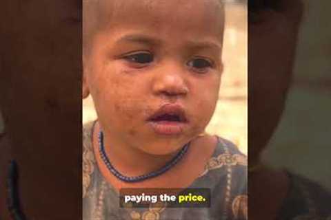 Gaza Famine: UN’s Shocking Warning | Gaza Turns Into a Famine Zone | Global Crisis Explained