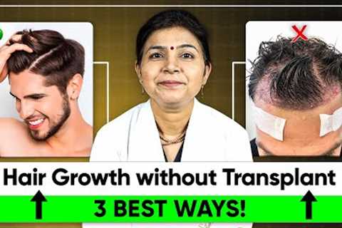 How to Regrow Hair Naturally without Hair Transplant | Hair Loss Treatment and Hair Growth