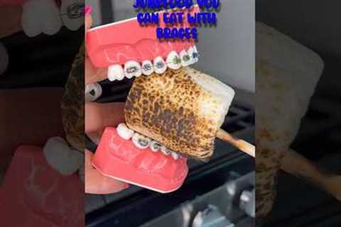 JUNKFOOD YOU CAN EAT WITHOUT BREAKING BRACES OFF 👀 ORTHODONTIST REACTS TO UNHEALTHY SNACKS 🦷