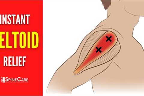 How to INSTANTLY Relieve Deltoid Pain
