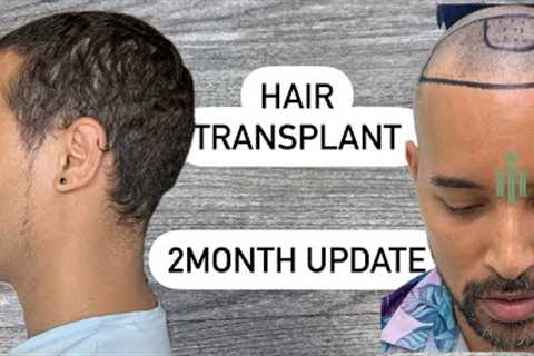 Hair Transplant 2 month Update