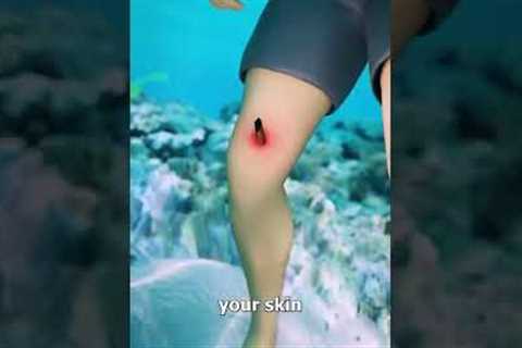 How Stingrays Actually Sting You 😳