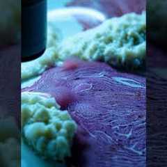 How 3D Printing is Revolutionizing Healthcare || 3d Printing || medical technology ||medical devices