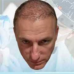 The Hair Dr - Hair Transplant Journey