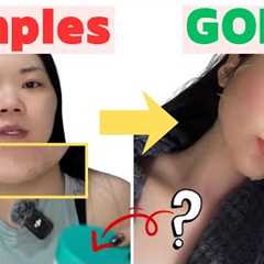 These 2 Korean Skincare Products Cleared My Pimples | Night Skincare Routine