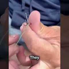 Fishing Hook Got Stuck😨