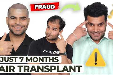 Hair Transplant in Mumbai | Best Results &amp; Cost of Hair Transplant in Mumbai