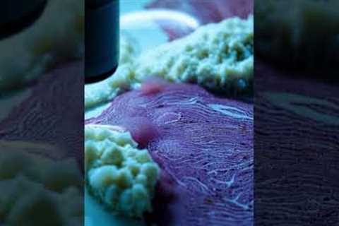 How 3D Printing is Revolutionizing Healthcare || 3d Printing || medical technology ||medical devices