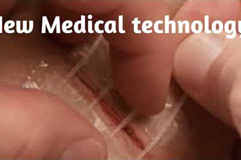 New Medical Technology