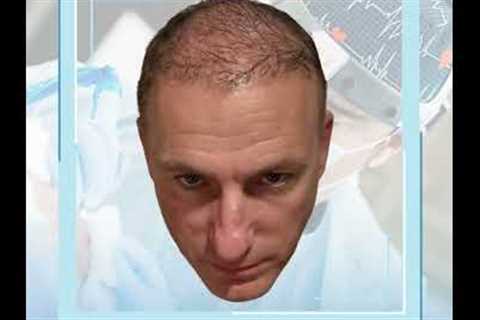 The Hair Dr - Hair Transplant Journey