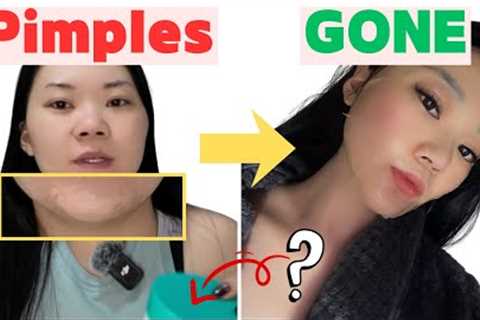 These 2 Korean Skincare Products Cleared My Pimples | Night Skincare Routine