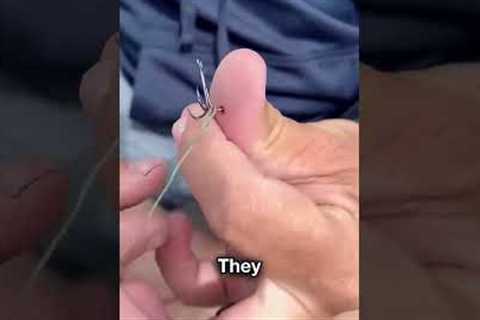 Fishing Hook Got Stuck😨