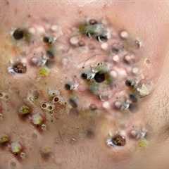 𝑨𝒄𝒉𝒊𝒆𝒗𝒆 𝑰𝒏𝒏𝒆𝒓 𝑷𝒆𝒂𝒄𝒆 𝑾𝒊𝒕𝒉 𝑻𝒉𝒆𝒔𝒆 𝑭𝒂𝒄𝒊𝒂𝒍 𝑪𝒍𝒆𝒂𝒏𝒔𝒊𝒏𝒈..