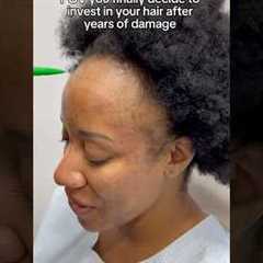 POV You Finally Decide to Invest in Your Hair! #hairgrowth #hairlosssolution