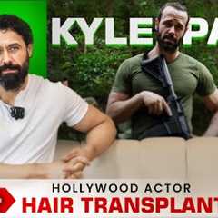 Hollywood Actor @kyle_paul Hair Transplant Journey | Amazing Hair Transplant Results in India