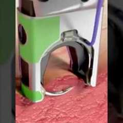 Automatic Surgical Stitch Devices! 😷 #goodtoknow #funfacts #vet #medicine #technology #suturing