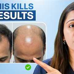Don't Waste Money On Hair Transplant