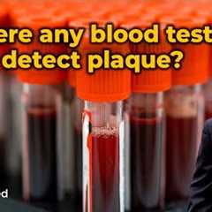 Is there any Blood Test to Detect Plaque?