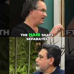 Hair Transplant Results: See Anthony's 9-Month Transformation! #shorts