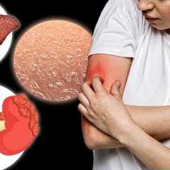 The 15 Causes of ITCHING You've Never Heard About