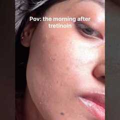 How I repair my dry irritated skin after tretinoin/retinol ✨ #acne #skincaretips #glassskin