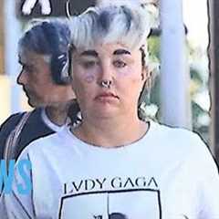 Amanda Bynes Reveals She Lost 28 Pounds With Ozempic | E! News