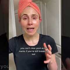 How to fade acne marks #dermatologist @DrDrayzday