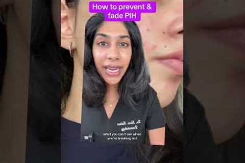 Post acne mark tips from a dermatologist #hyperpigmentation #skincare