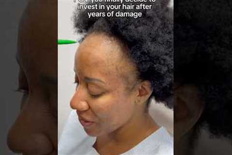 POV You Finally Decide to Invest in Your Hair! #hairgrowth #hairlosssolution