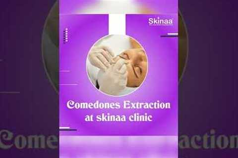 Here's A Quick Way To Solve The Comedones Extraction Problem | Viral #shorts