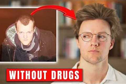 Hair Loss Industry Exposed! - How I regrew my hair after 10 years of male pattern baldness