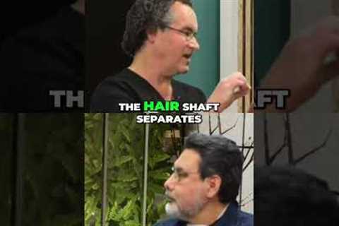Hair Transplant Results: See Anthony's 9-Month Transformation! #shorts
