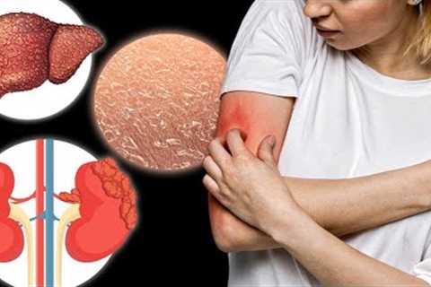 The 15 Causes of ITCHING You've Never Heard About