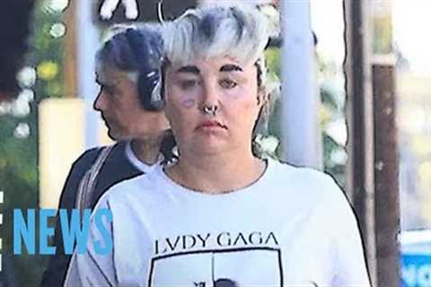Amanda Bynes Reveals She Lost 28 Pounds With Ozempic | E! News