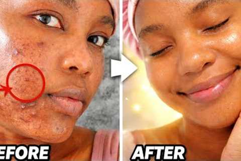 2 Minutes Clear Face Routine (Only 3 Products)