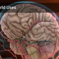 Arduino for Beginners What is it and Why You Should Care!