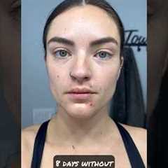 How my face changed with 8 days no alcohol #dryjanuary #sober #sobriety #shortsvideo #shorts