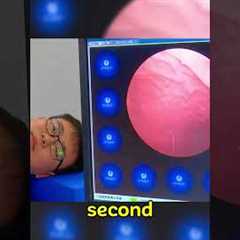 China’s Genius Endoscopy Capsule Replaces Painful Tubes! 🤯 | Medical Innovation #technology
